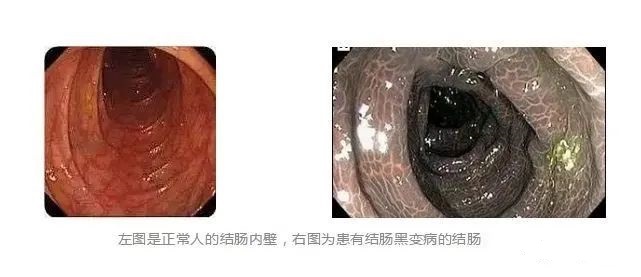 神奇的利那洛肽